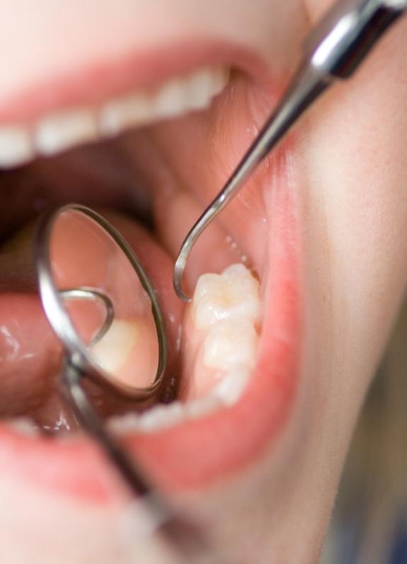 Close up of child receiving a dental exam