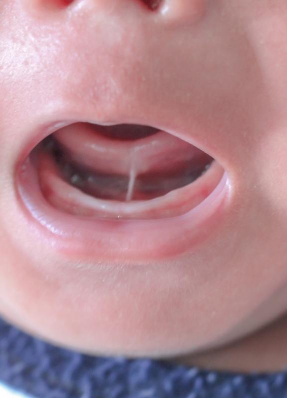 Close up of baby opening their mouth wide