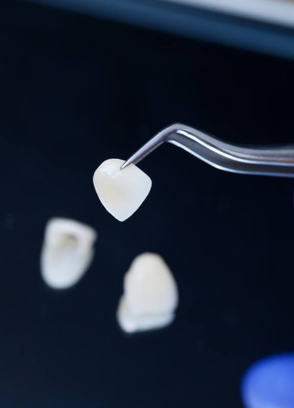 Gloved hand holding a dental veneer with tweezers