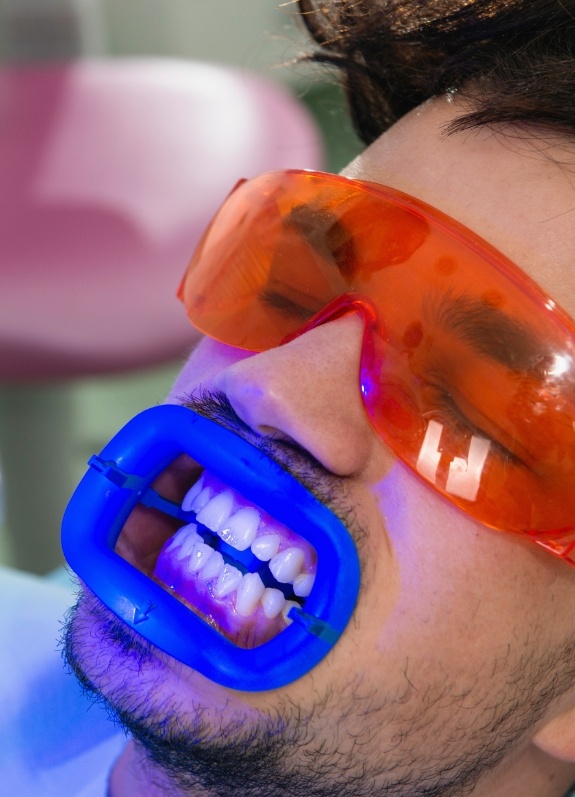 Man receiving professional teeth whitening from cosmetic dentist