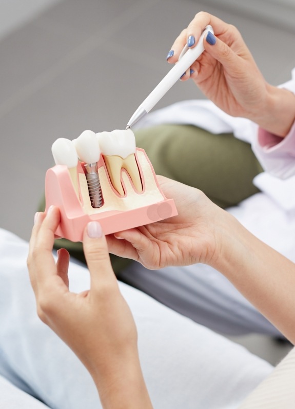 Dentist showing a model of a dental implant to a patient