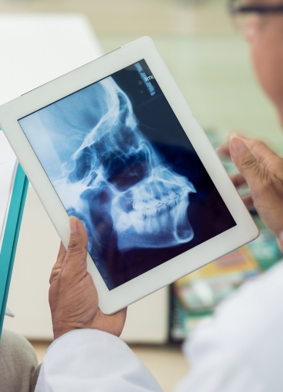 Dentist looking at x ray of jaws