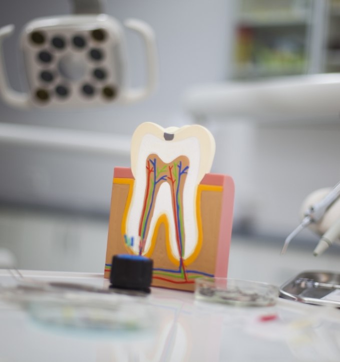 Model of decayed tooth that needs root canal treatment in Jonesboro